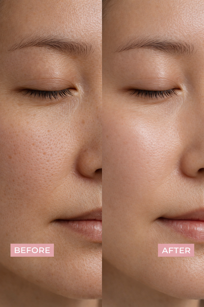 Lip Glow Instant Line Filling Shot 2000 Serum