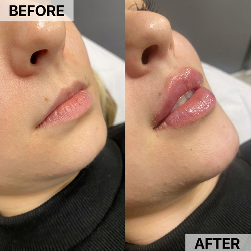 LipGlow Volume Plumping Serum